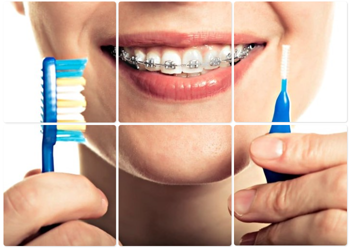 Instructions To Patients